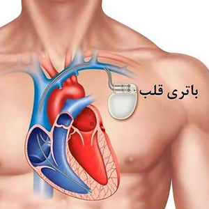باتري قلب يا همان باتري‌هاي ليتيوم-يون